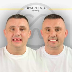 1-4-1024x1024-1
