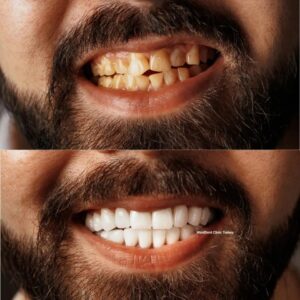 westdent-before-after-1