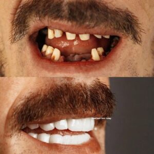 westdent-before-after-2-2