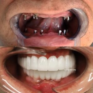 westdent-before-after-27