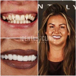 1after-dental-treatment-before-after-photo-of-patient